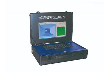 超声骨密度仪 超声骨密度仪